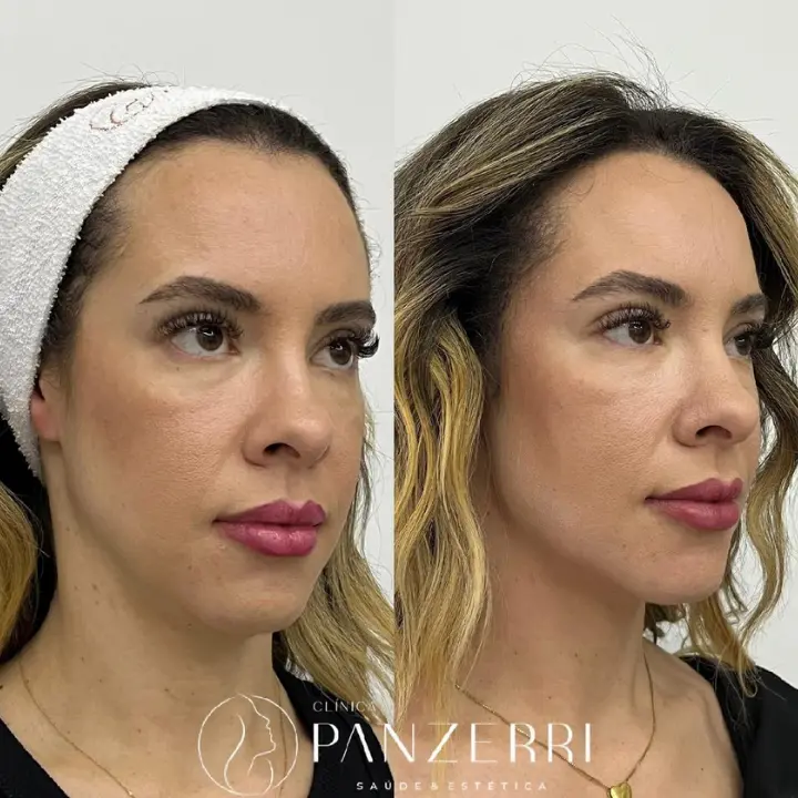 AnyConv.com__FACIAL-1