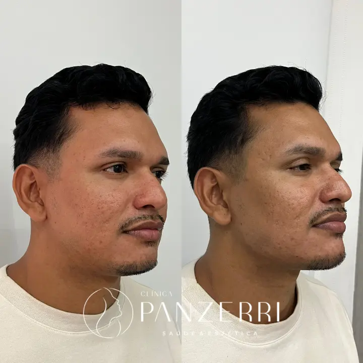 AnyConv.com__FACIAL-2