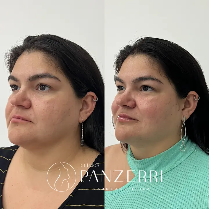 AnyConv.com__FACIAL-3