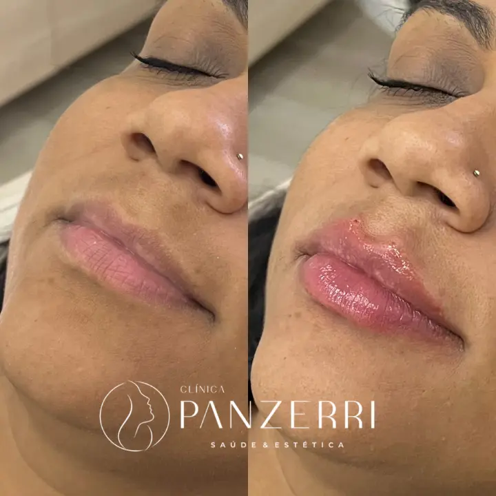 AnyConv.com__LABIAL-1