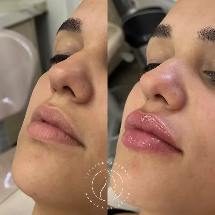 AnyConv.com__LABIAL-2