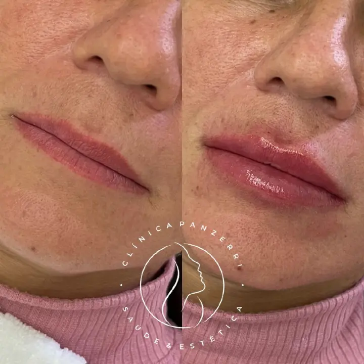 AnyConv.com__LABIAL-3